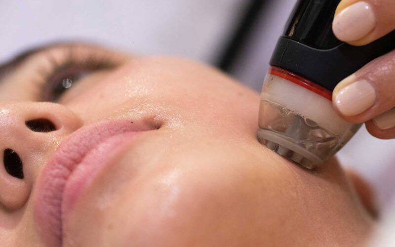 Pulizia_Viso_Dermaclear_ravvicinata_Alma_Beauty-e1710512589975